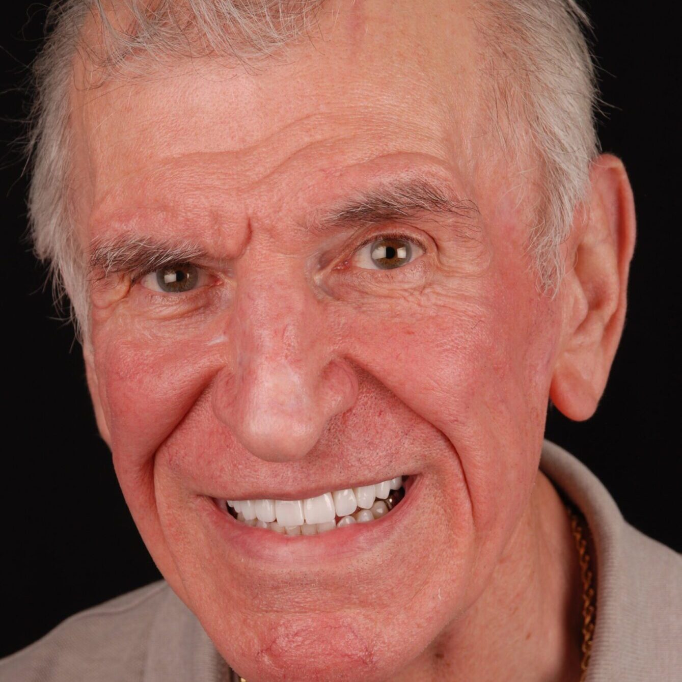 Bob – Face After After