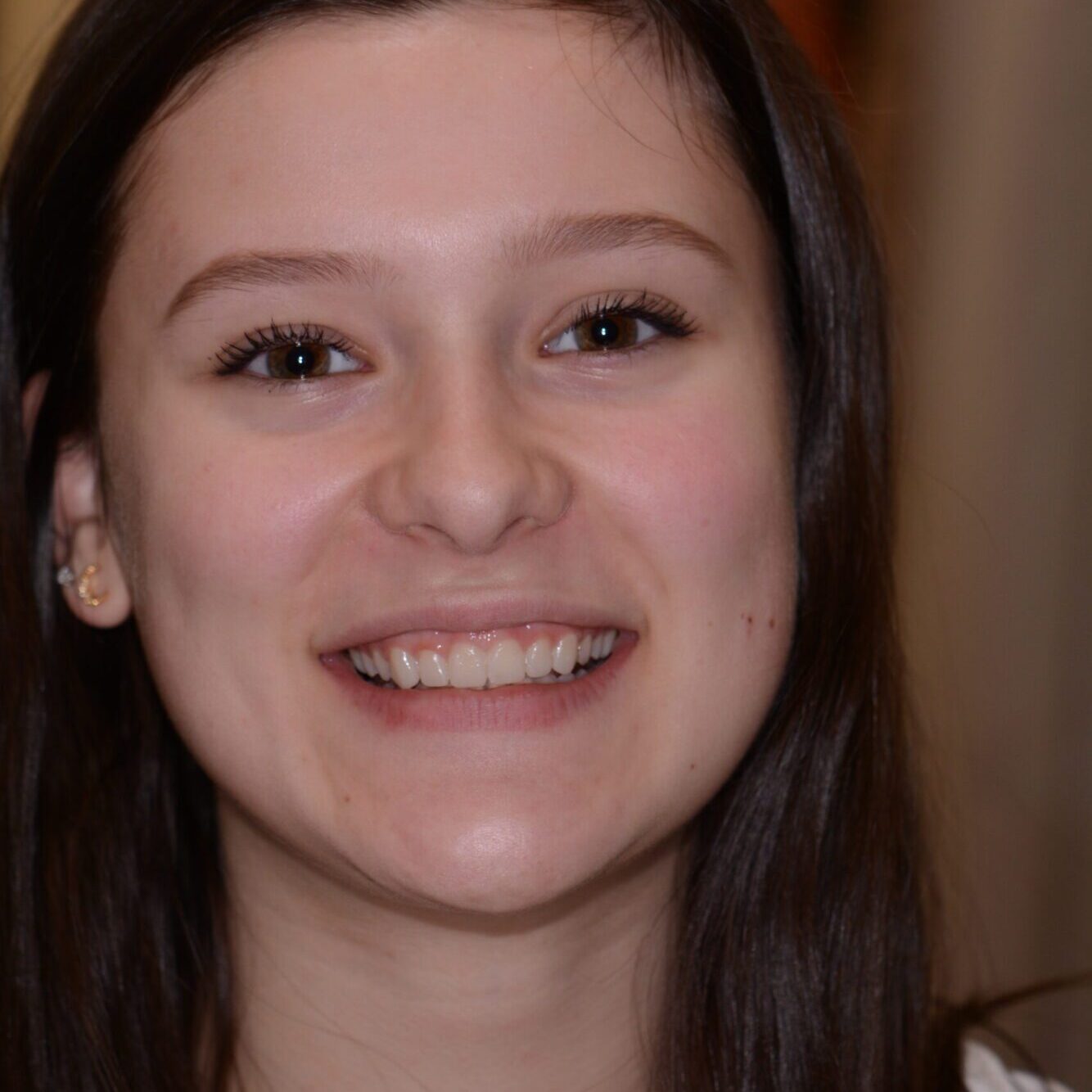 Chelsea – Face After After