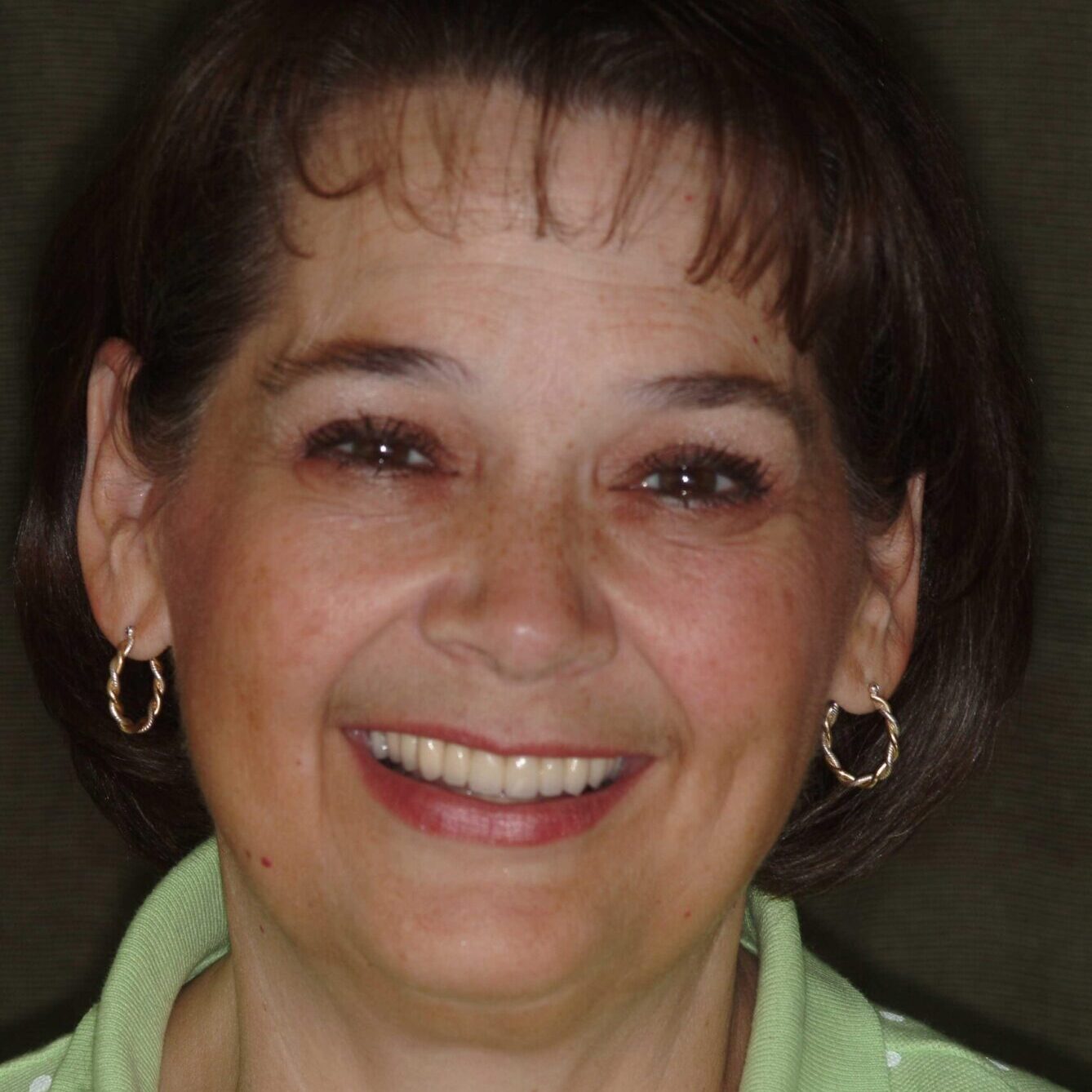 Joy – Face After After