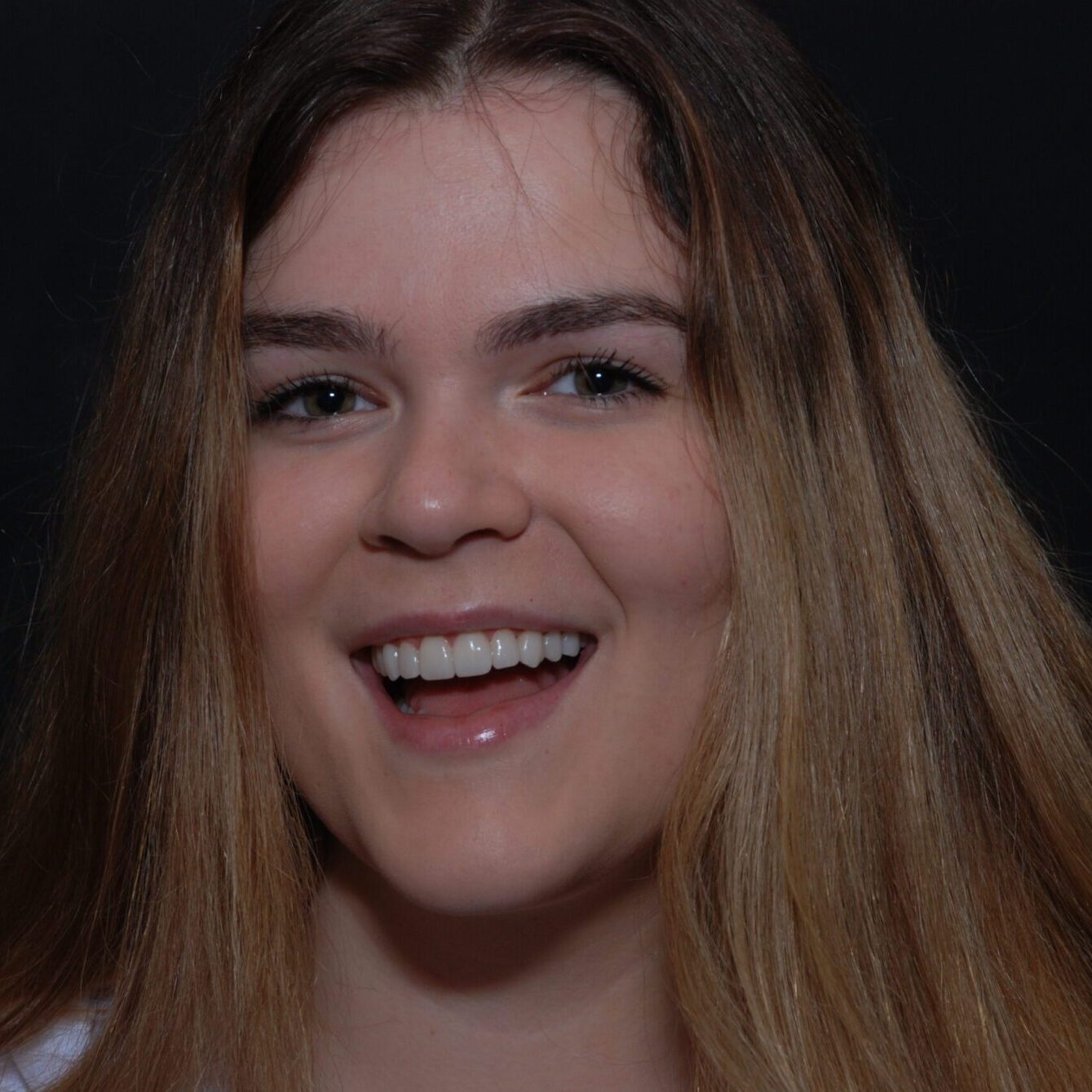 Payton – Face After After