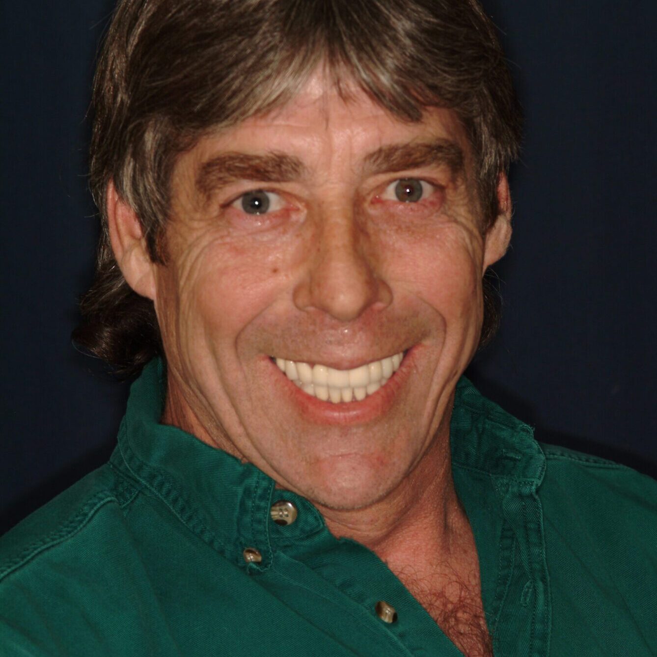 Stan – Face After After