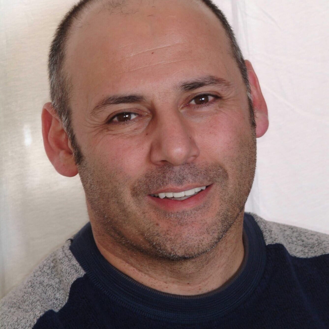 Andrew – Face After After