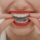 Taking Care of Your Invisalign Trays