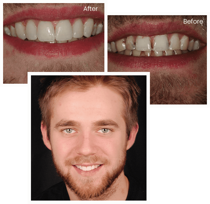 Bobby's Story Bobby's Story