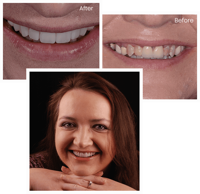 Brandaleny's Story Brandaleny's Story