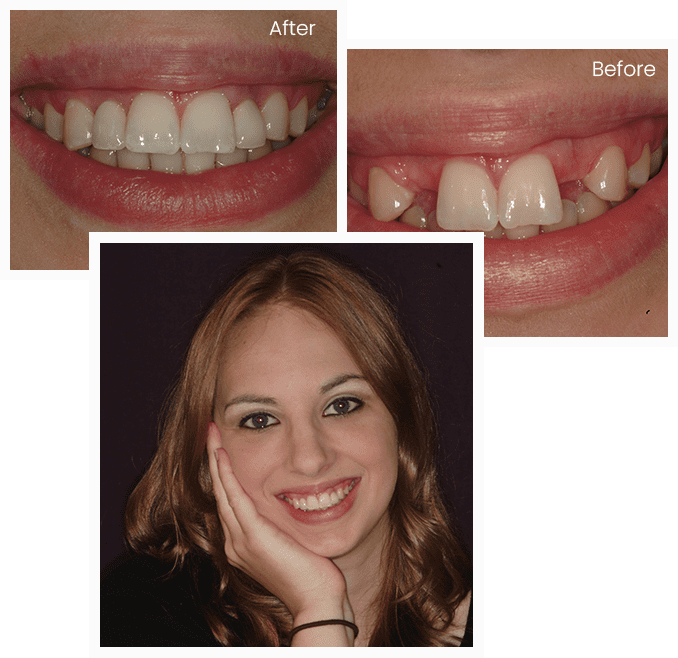 Kayla's Story Kayla's Story