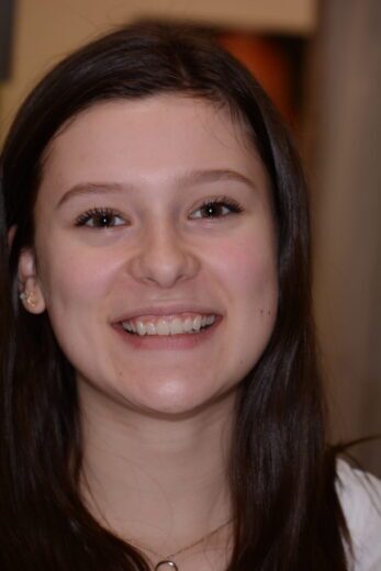 Chelsea – Face After After