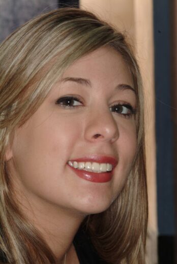 Rachael – Face After After