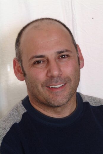 Andrew – Face After After